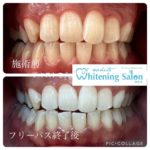 画像に alt 属性が指定されていません。ファイル名: image-3-1024x1024.jpg